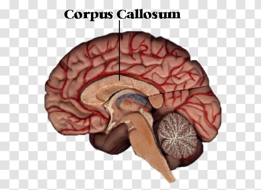 Corpus Callosum Brain Callosotomy Cerebral Hemisphere Human Body - Silhouette Transparent PNG