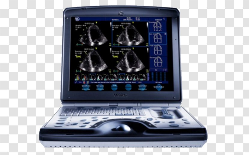 Ultrasonography SonoSite, Inc. GE Healthcare Cardiology Medical Equipment - Multimedia - Hardware Transparent PNG