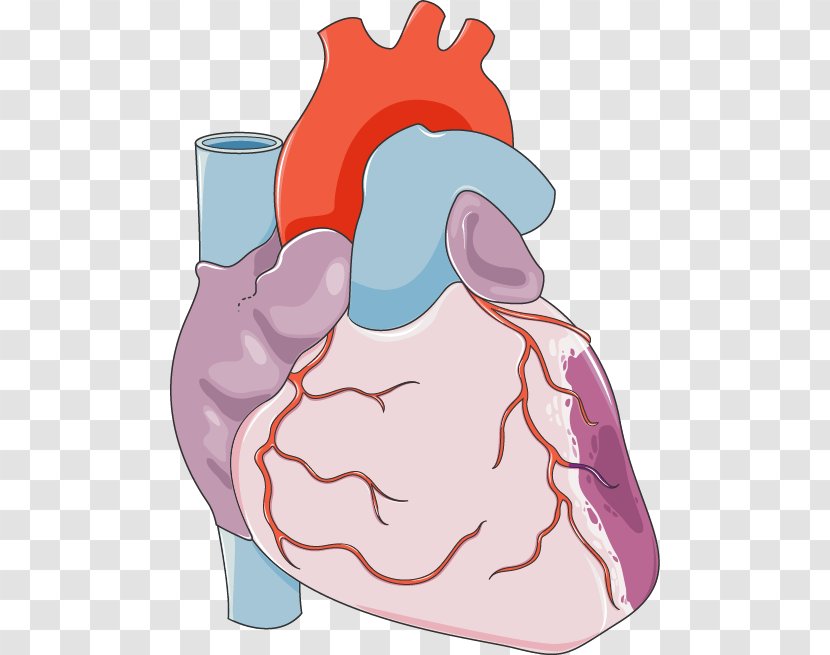 Heart Coronary Artery Bypass Surgery Disease Cardiovascular - Watercolor Transparent PNG