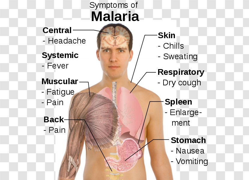 Malaria Symptomatic Treatment Chills Plasmodium Falciparum - Watercolor - Tree Transparent PNG