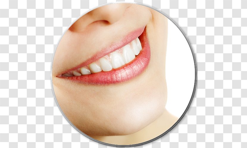 Bleach Tooth Whitening Dentistry - Cosmetic Transparent PNG