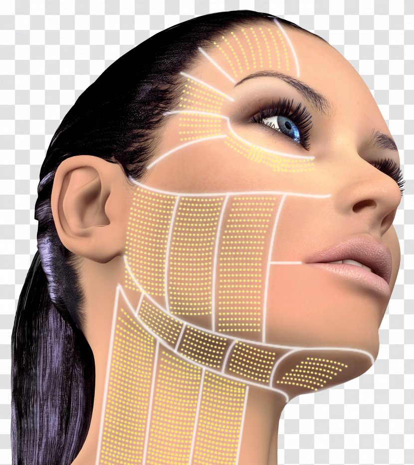High-intensity Focused Ultrasound Therapy Rhytidectomy Surgery Skin - Forehead - About Us Transparent PNG