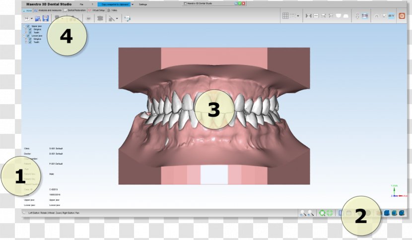 Dentistry Computer Software Product Manuals Open Dental Orthodontics - Frame - Silhouette Transparent PNG