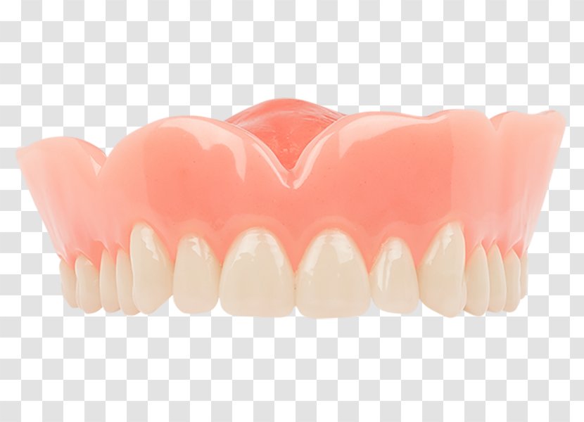 Tooth Dentures Dentistry Aspen Dental - Extraction - Crown Transparent PNG