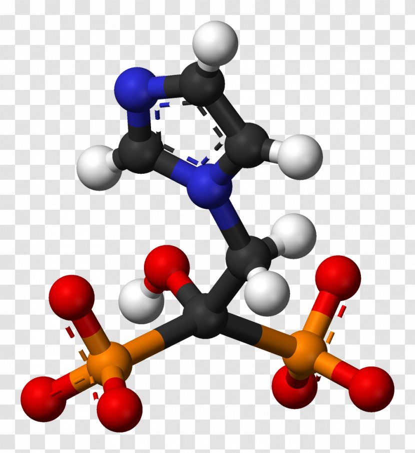 Alendronic Acid Osteoporosis Zoledronic Bisphosphonate Bone Density - Medical Diagnosis Transparent PNG