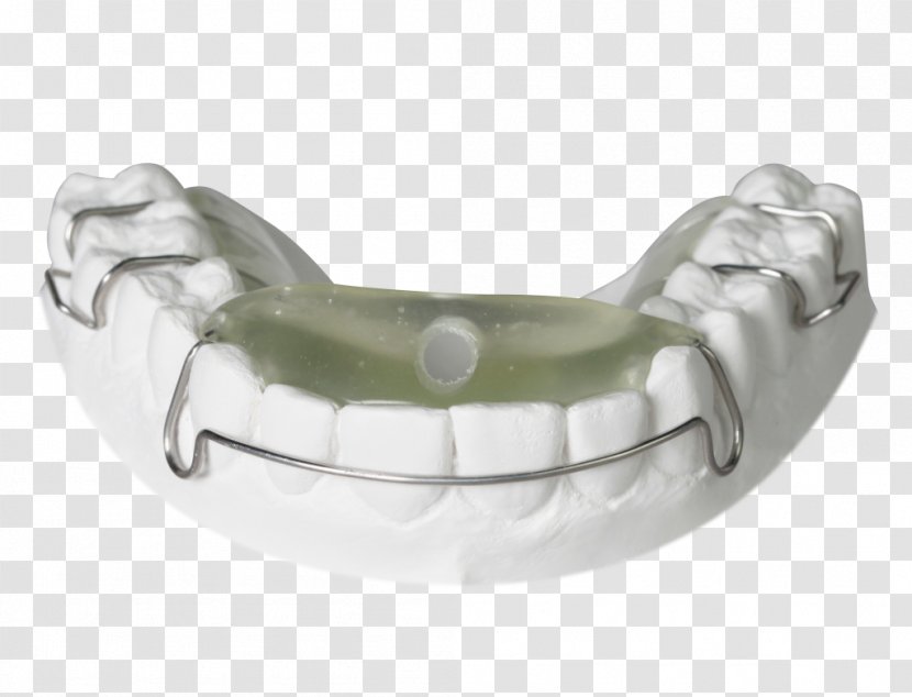 Sleep Apnea Orthodontics And Breathing Dentist - Splint Transparent PNG