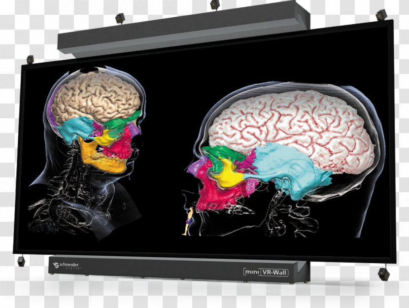 Display Device Brain Transparent PNG