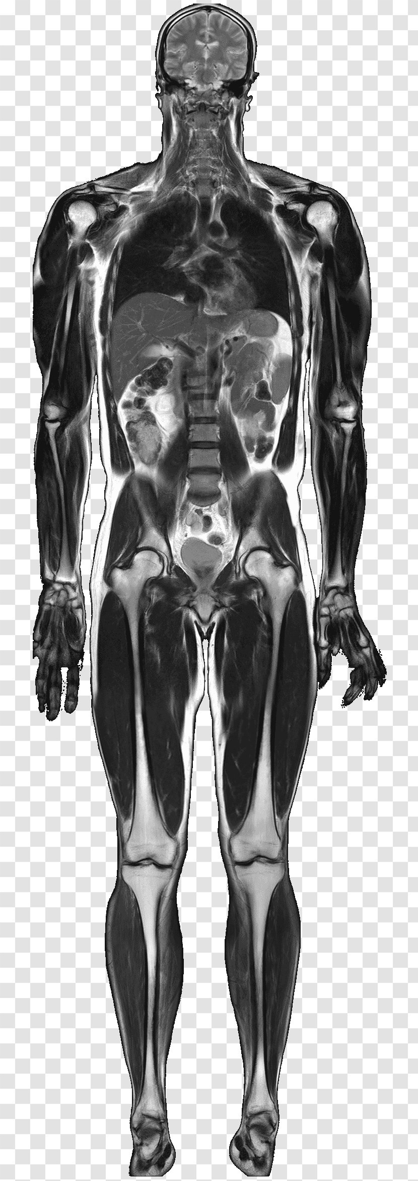 Magnetic Resonance Imaging Medical Anatomy Human Body Nuclear - Frame - Standard Transparent PNG