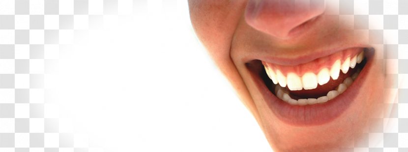 Tooth Smile Lip Cheek Mouth - Silhouette - Surgery Transparent PNG