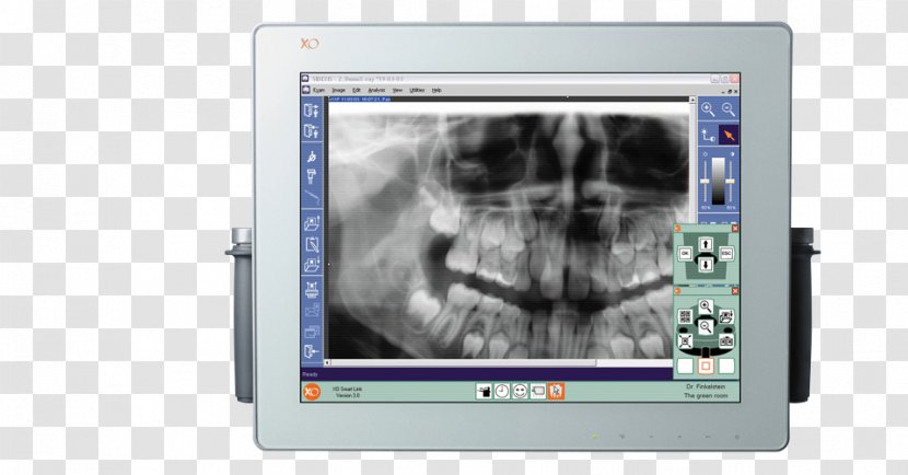 Dentistry Orthodontics Dental Surgery - Implant - Medical Equipment Transparent PNG