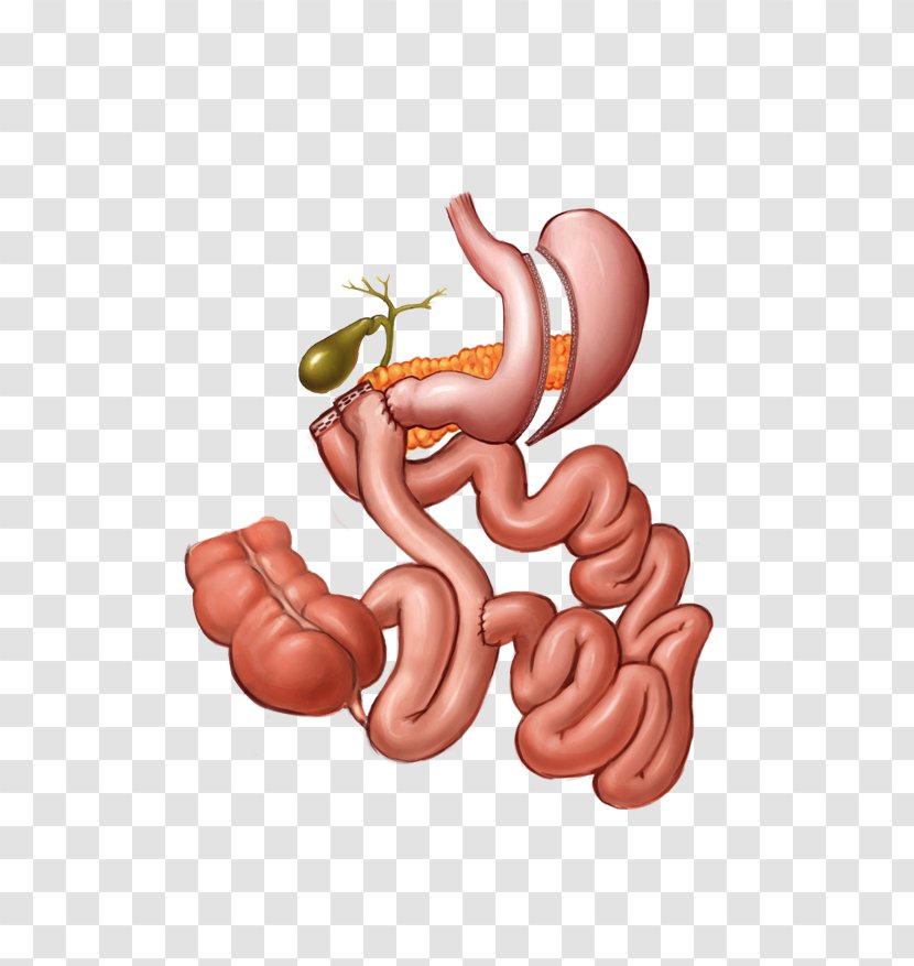 Thumb Kielbasa Cartoon Organism - Flower - Duodenal Switch Transparent PNG