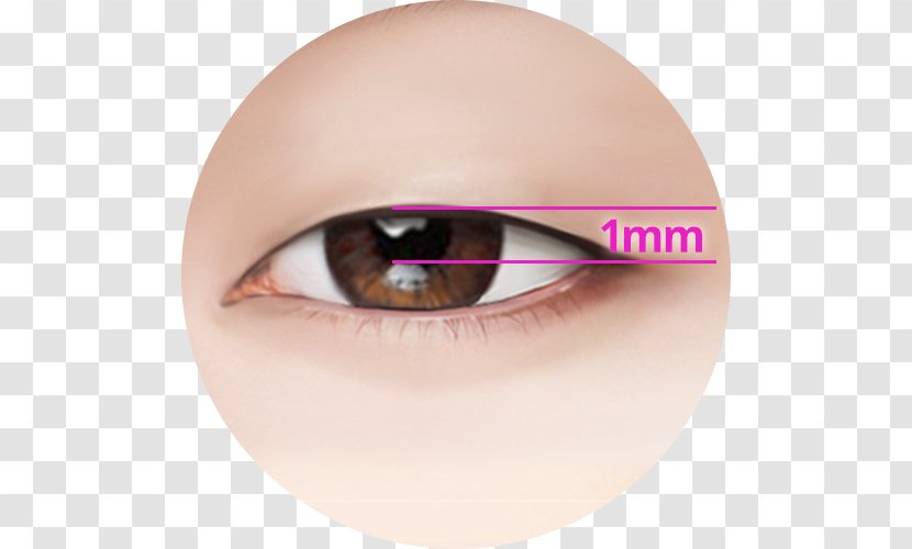 Ptosis Eyelid Surgery Intervenție Chirurgicală - Eye Shadow - Correction Transparent PNG