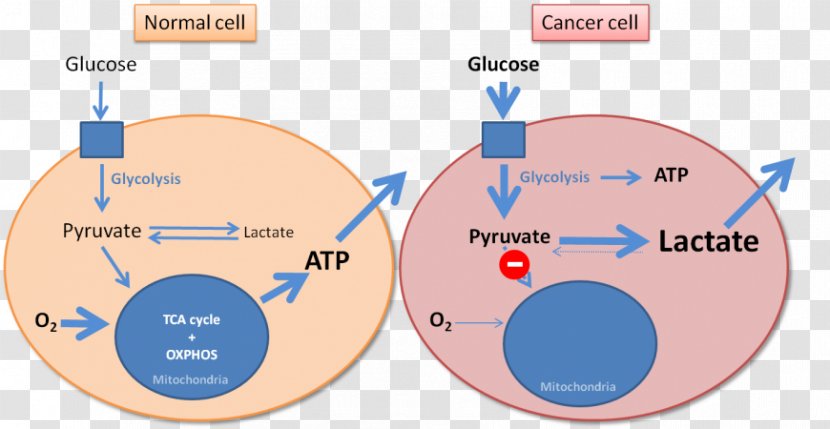 Warburg Effect Cancer Hypothesis Glycolysis Metabolism - Technology Sensitivity Transparent PNG
