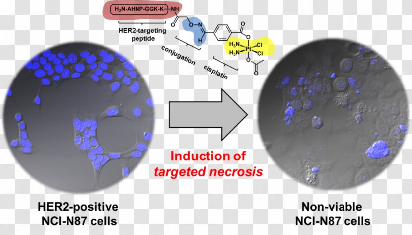 Sphere Font - Cancer Cell Of Globular Pathogen Transparent PNG
