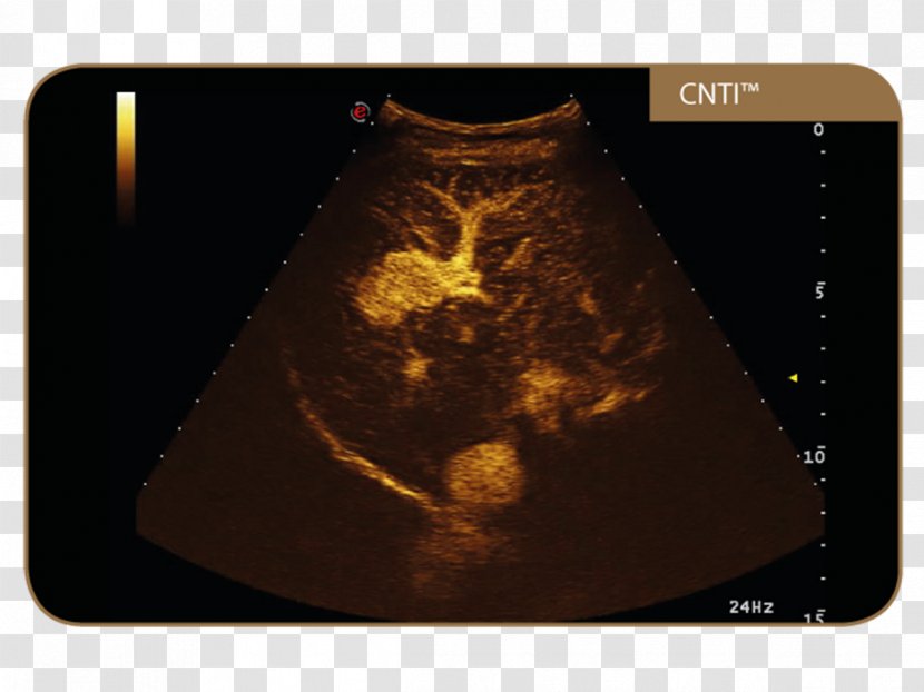 Esaote Ultrasonography Contrast-enhanced Ultrasound Contrast Agent - Technology Transparent PNG