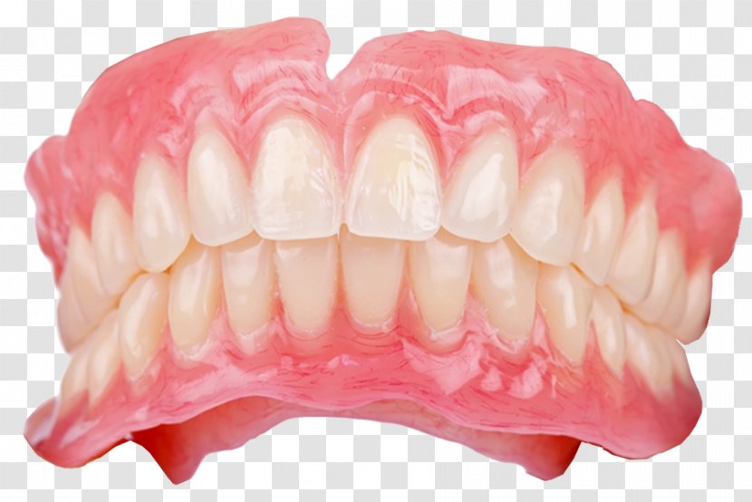 Dentistry Dental Implant Dentures Laboratory Technician - Bridge - Sleep Over Transparent PNG