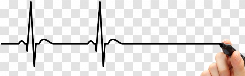 Electrocardiography Heart Arrhythmia Cardiac Muscle Drawing Acute Myocardial Infarction - Palpitations - Ecg Transparent PNG