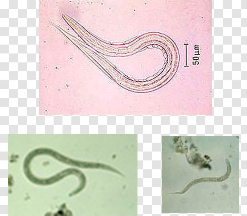 Ancylostoma Duodenale Hookworm Infection Centers For Disease Control And Prevention Invertebrate Email - Slip N Slide Transparent PNG