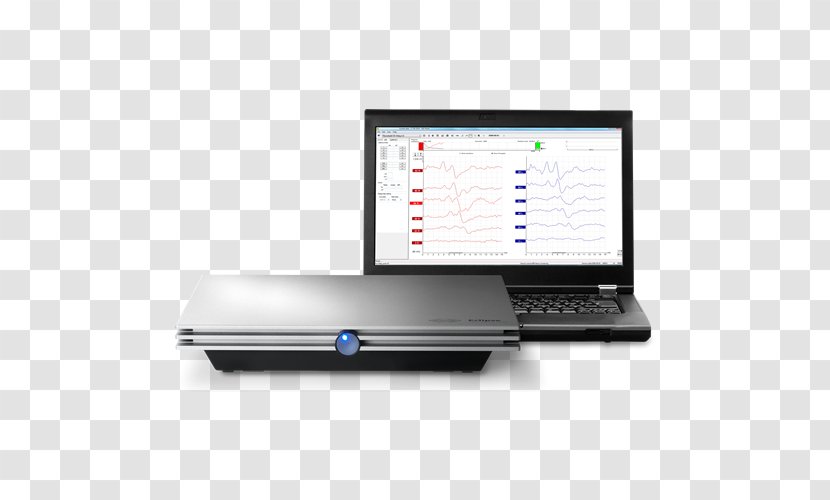 Vestibular Evoked Myogenic Potential Hearing Audiometry CENTRO AUDIOLOGICO PENSIONES - Stimulus Transparent PNG