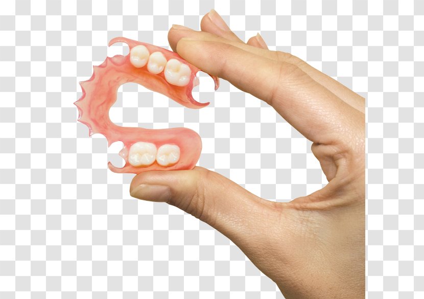 Removable Partial Denture Dentures Dentistry Prosthodontics - Dental Hygienist - Bridge Transparent PNG