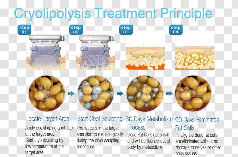 Cryolipolysis Adipose Tissue Adipocyte Fat Apoptosis - Weighing-machine Transparent PNG
