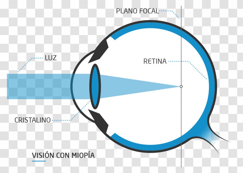 Presbyopia Floater Eye Far-sightedness Near-sightedness Transparent PNG