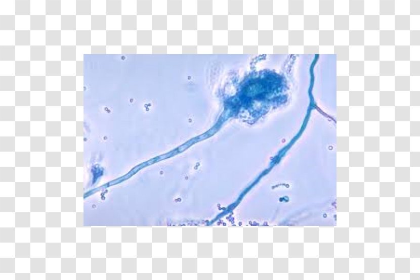 Aspergillus Fumigatus Fungus Aspergillosis Aspergilloma Infection Transparent PNG