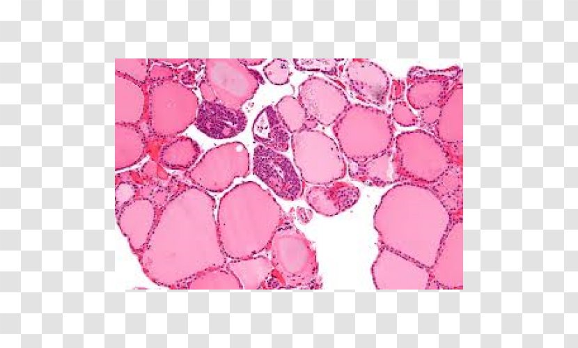 Centro Medico Sant'Angelo Medicine Surgery Thyroid Therapy - Meiosis I - Gland Transparent PNG