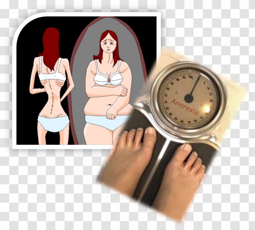 Anorexia Nervosa Binge Eating Disorder Bulimia Poor Appetite Transparent PNG