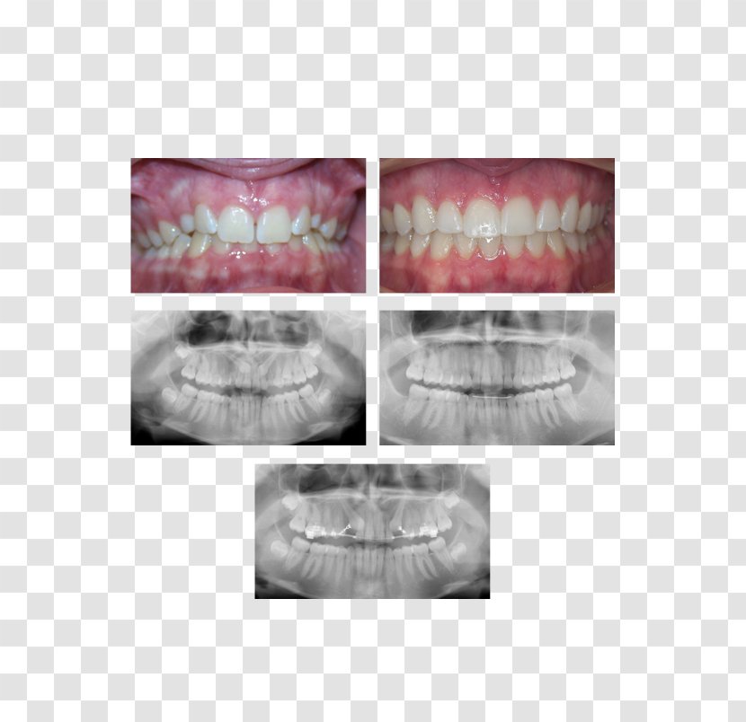 Palatine Mount Prospect Arlington Orthodontics Dental Braces - Silhouette - Chris Pugeda Dmd Transparent PNG