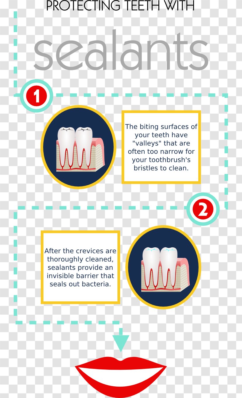Dentistry Tooth Gums Bridge Gingivitis - Endodontics Transparent PNG