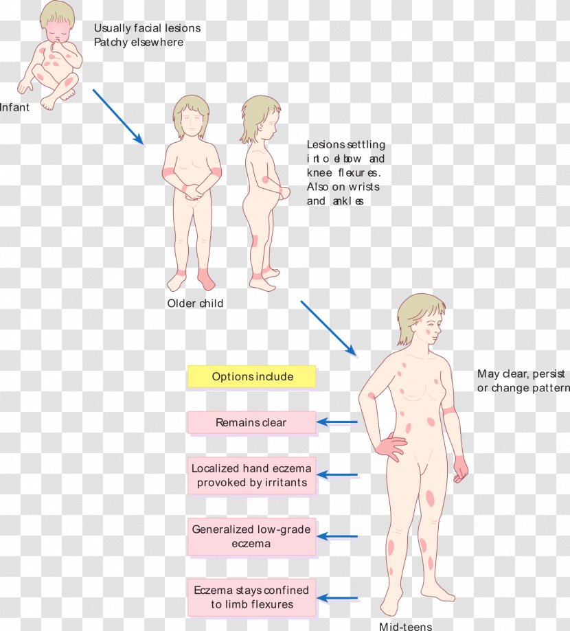 Atopic Dermatitis Atopy Disease Itch - Frame - Aging Transparent PNG