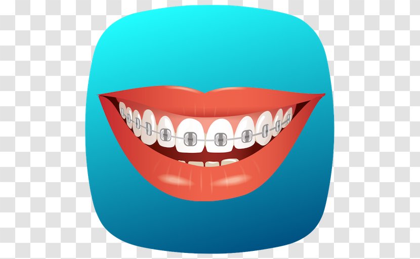 Dental Braces Vector Graphics Royalty-free Smile Lips - Frame Transparent PNG