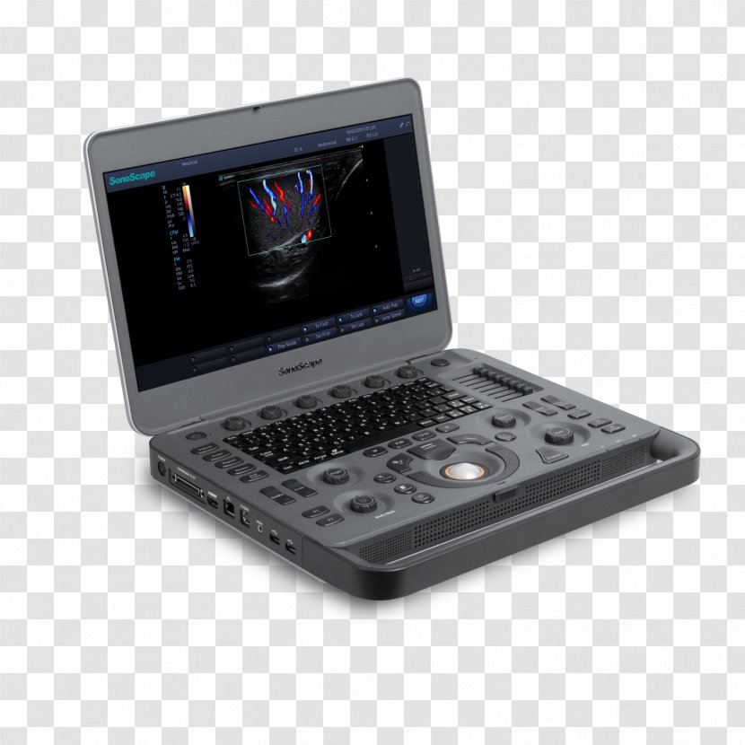 Ultrasound Doppler Ultrasonography SonoScape Medical Corp Color - Imaging - Machine Transparent PNG