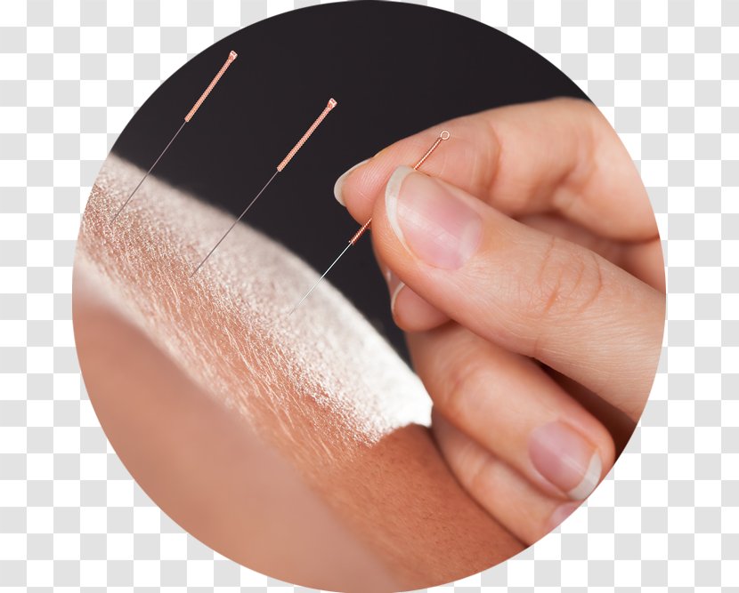Acupuncture Physical Therapy Traditional Chinese Medicine - Acupuntura Transparent PNG