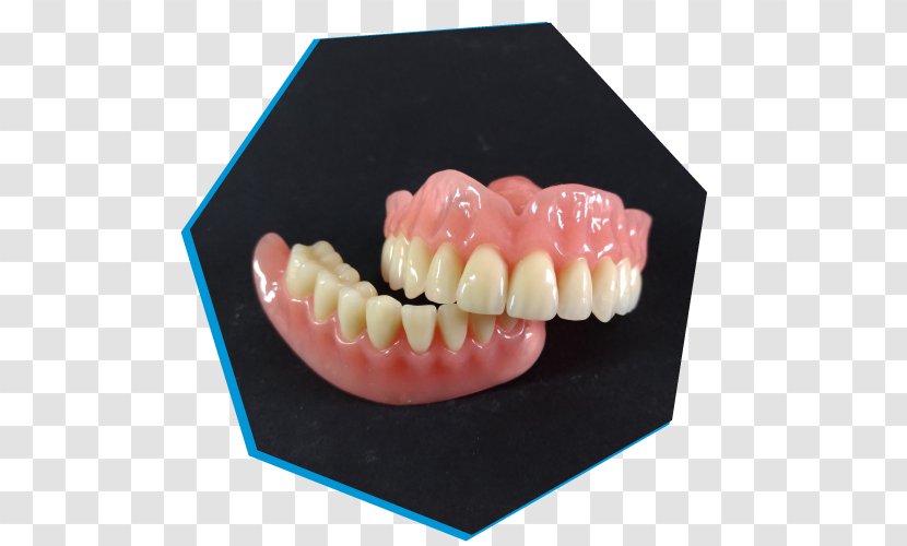 Brembio Dental Laboratory Dentures Tooth Sant'Angelo Lodigiano - Technology Transparent PNG