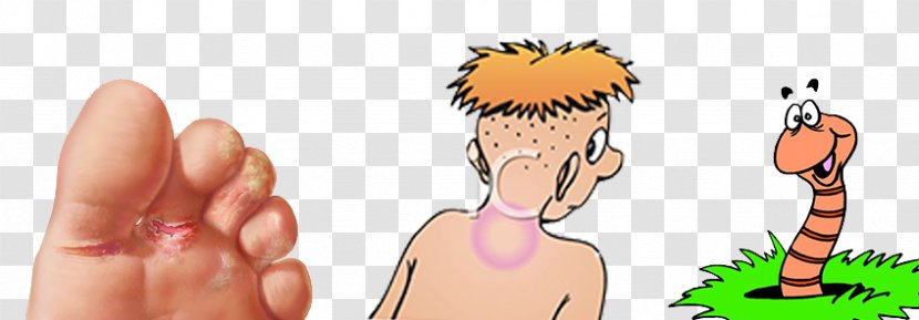 Ringworm Skin Infection Mycosis Tinea Capitis - Sign Language Transparent PNG