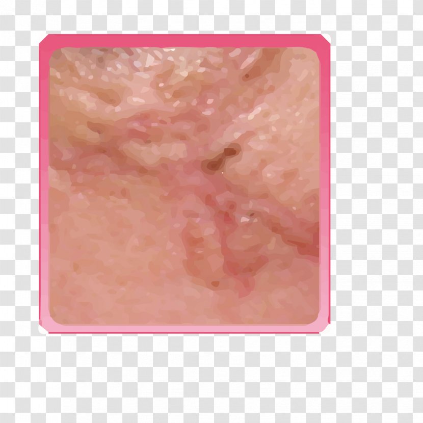 Skin Pink - Flower - Surgical Scars Transparent PNG