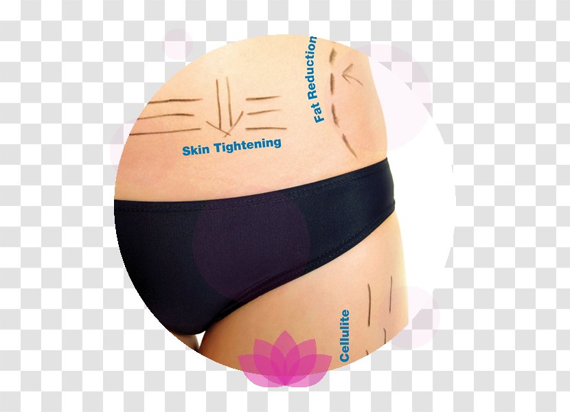 Radio Frequency Skin Tightening Human Body - Cartoon Transparent PNG