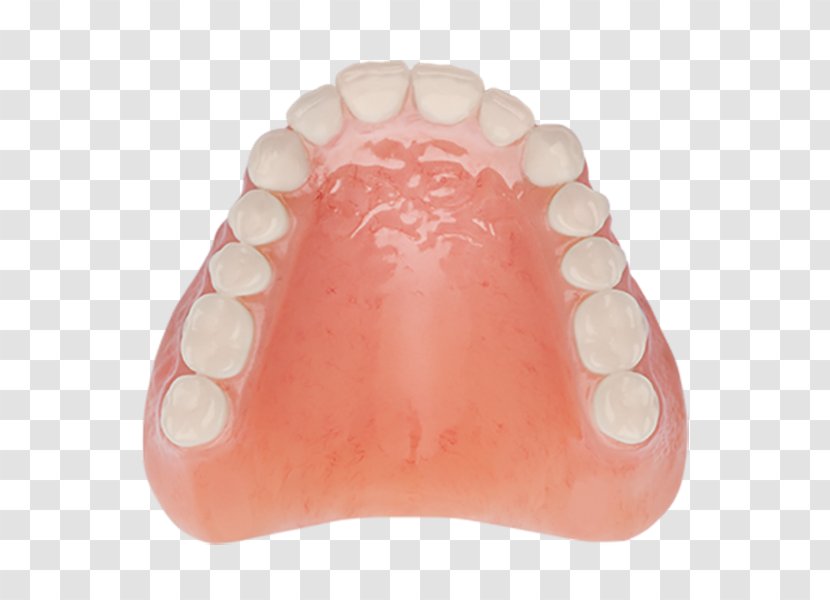 Tooth Dentures Dentistry Removable Partial Denture Aspen Dental - Nail Transparent PNG