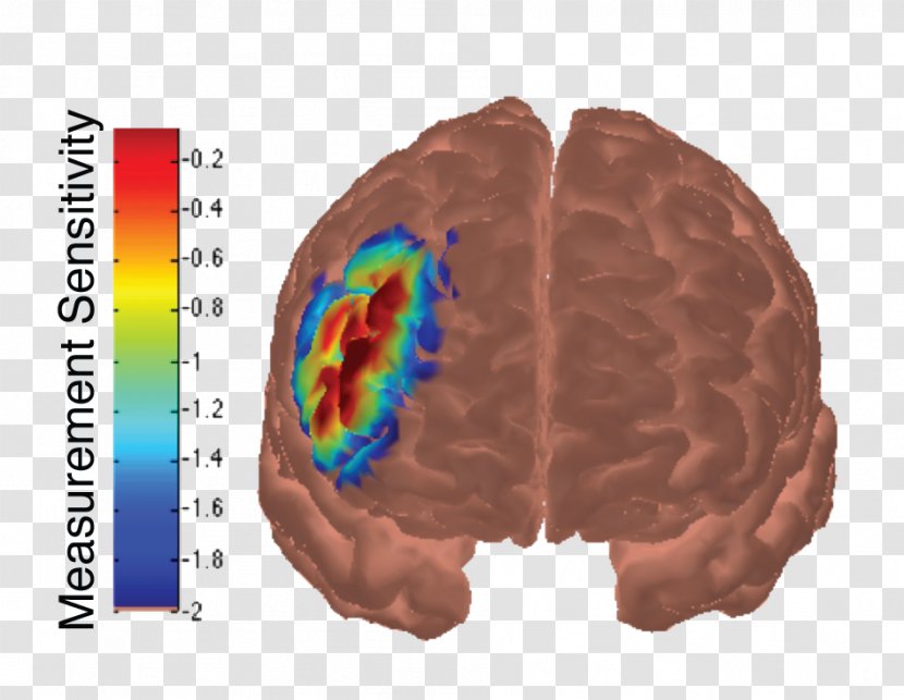 Brain Dorsolateral Prefrontal Cortex Cerebral Frontal Lobe - Cartoon - Metaphor Transparent PNG