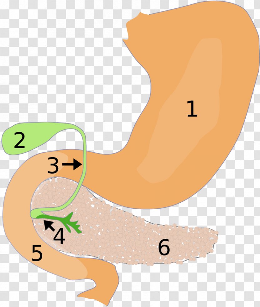 Papillentumor Pancreas Duodenum Gallbladder Pancreatitis - Tree - Cartoon Transparent PNG
