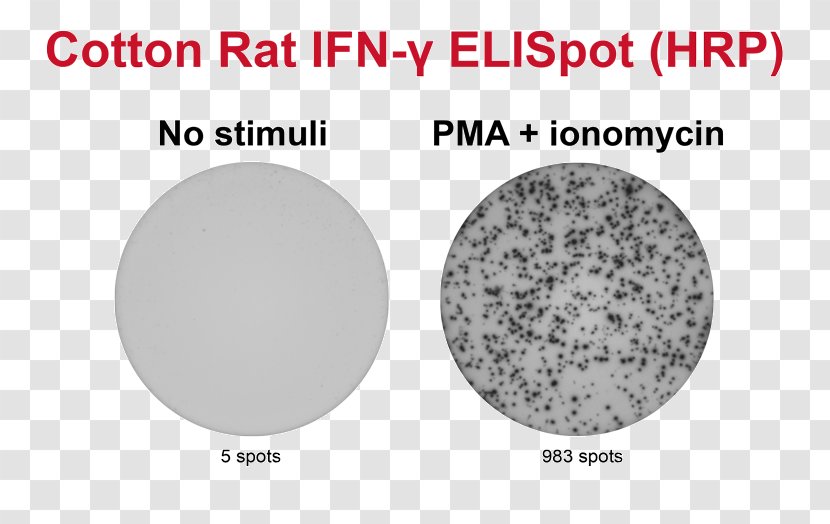 ELISPOT Peripheral Blood Mononuclear Cell Secretion Interferon Gamma - Spleen Transparent PNG
