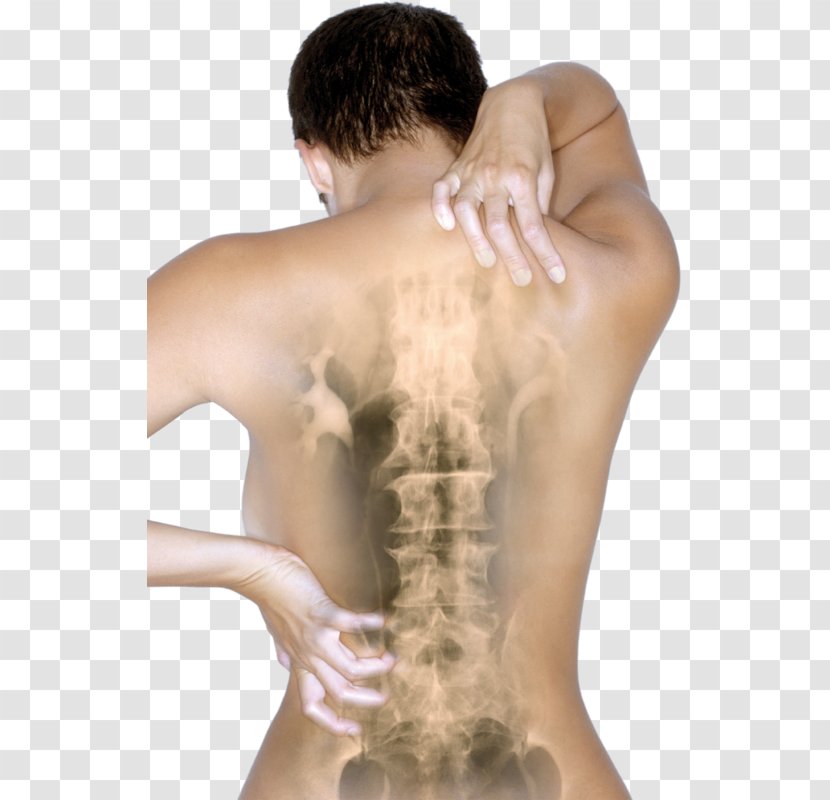 Osteochondrosis Vertebral Column Disease Mugurkaula Osteohondroze Pain - Cartoon - Columna Transparent PNG