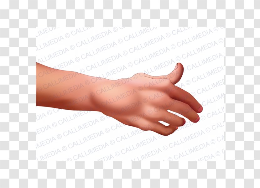 Thumb Rheumatoid Arthritis La Artritis Rheumatism - Hand Transparent PNG