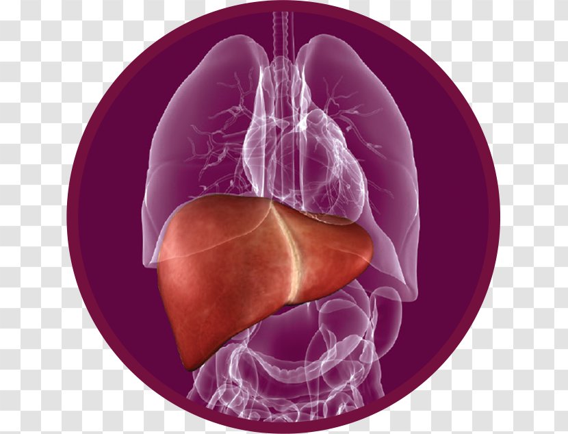 Fatty Liver Disease Therapy Cirrhosis - Cartoon - Tree Transparent PNG