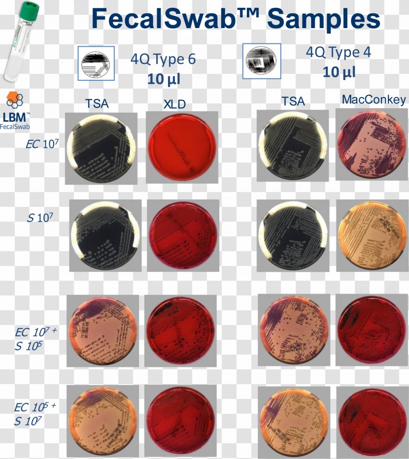 Streaking XLD Agar MacConkey Microbiology - Macconkey - Quadrant Epp Usa Inc Transparent PNG