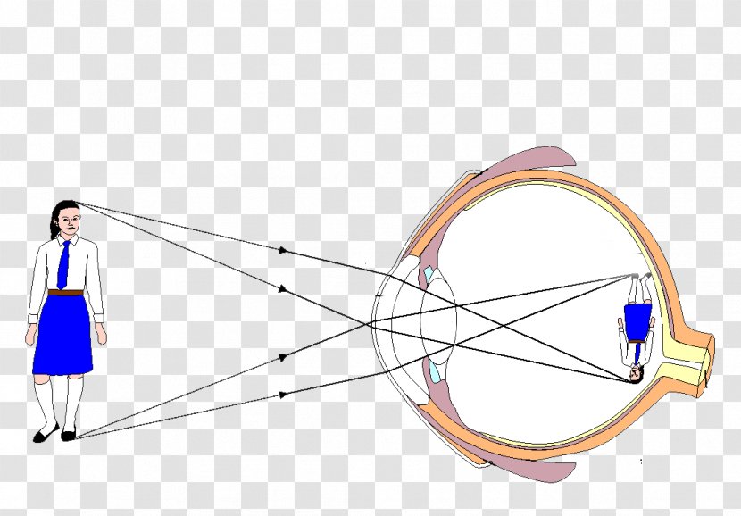 Eye Pattern Diagram Light Human - Scleral Tattooing Transparent PNG