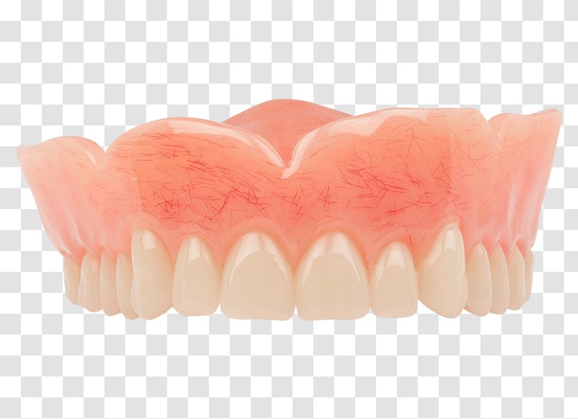 Tooth Dentures Dentistry Dental Implant - Jaw - Aspen Transparent PNG