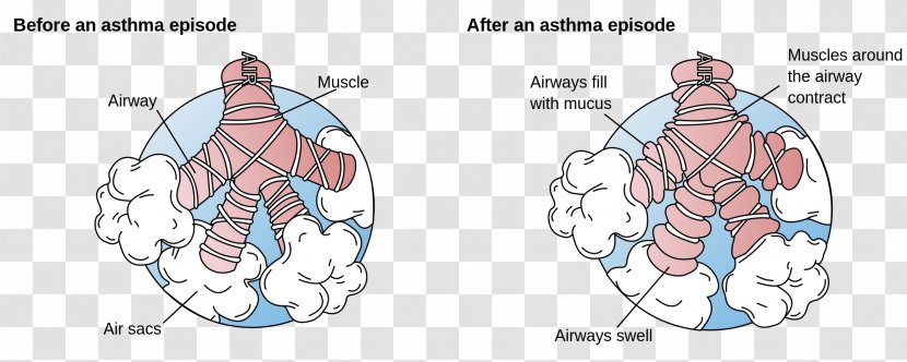 Asthma Bronchus Dyspnea Bronchospasm Disease - Flower - Lung Transparent PNG
